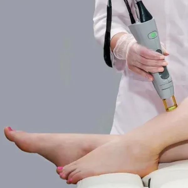 Laser Hair Removal
